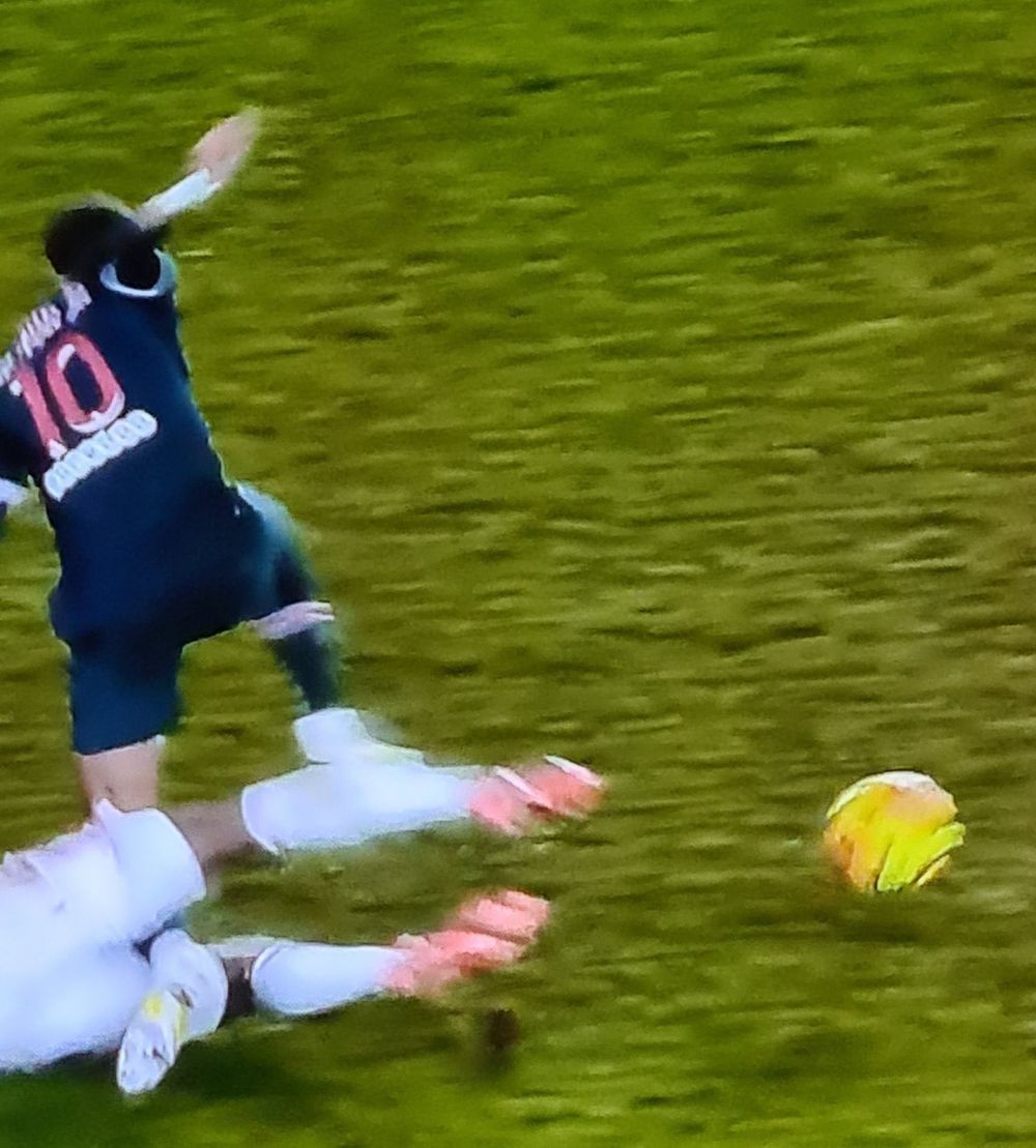 ATENTIE, IMAGINI SOCANTE! Neymar, accidentare CUTREMURATOARE! A inceput sa urle de durere si sa planga! Stirea face inconjurul lumii_5