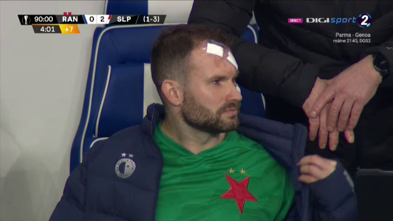 Atentie, imagini socante! Atac monstruos: i-a spart capul pur si simplu cu o lovitura dementa in Rangers - Slavia! Cum arata capul portarului dupa atac_3