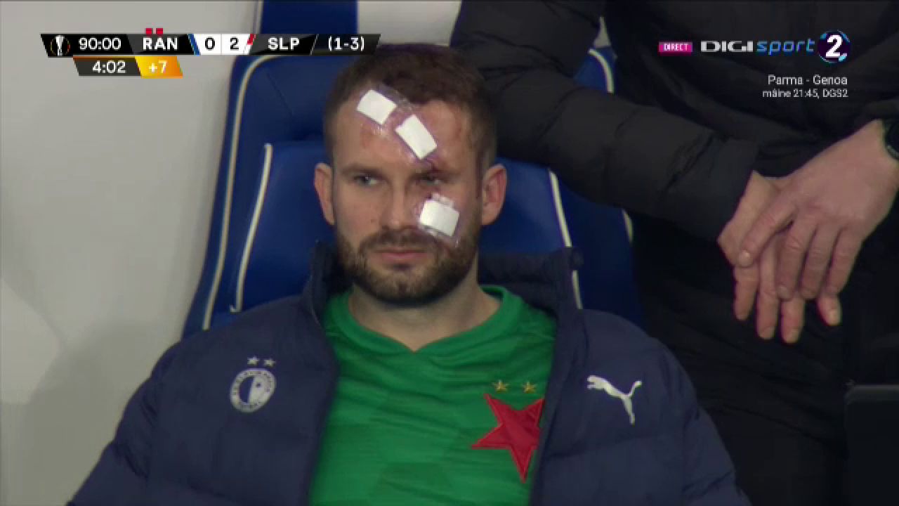 Atentie, imagini socante! Atac monstruos: i-a spart capul pur si simplu cu o lovitura dementa in Rangers - Slavia! Cum arata capul portarului dupa atac_5