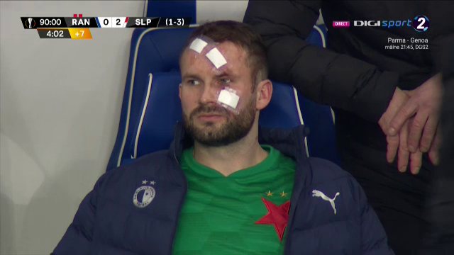 Atentie, imagini socante! Atac monstruos: i-a spart capul pur si simplu cu o lovitura dementa in Rangers - Slavia! Cum arata capul portarului dupa atac_6