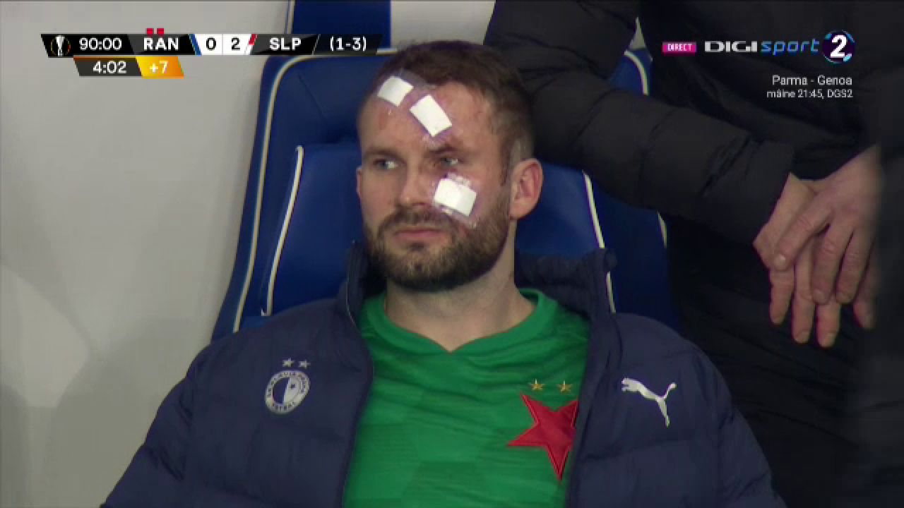 Atentie, imagini socante! Atac monstruos: i-a spart capul pur si simplu cu o lovitura dementa in Rangers - Slavia! Cum arata capul portarului dupa atac_6