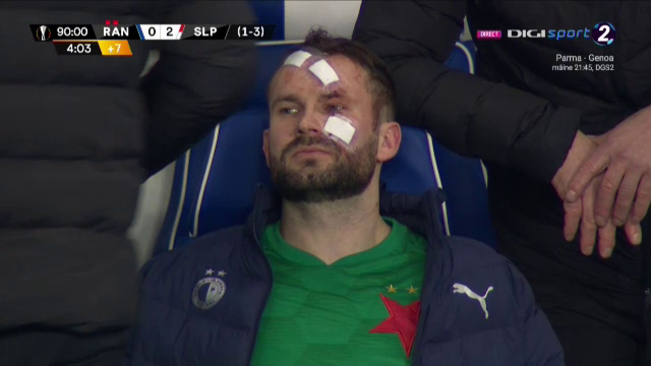 Atentie, imagini socante! Atac monstruos: i-a spart capul pur si simplu cu o lovitura dementa in Rangers - Slavia! Cum arata capul portarului dupa atac_7
