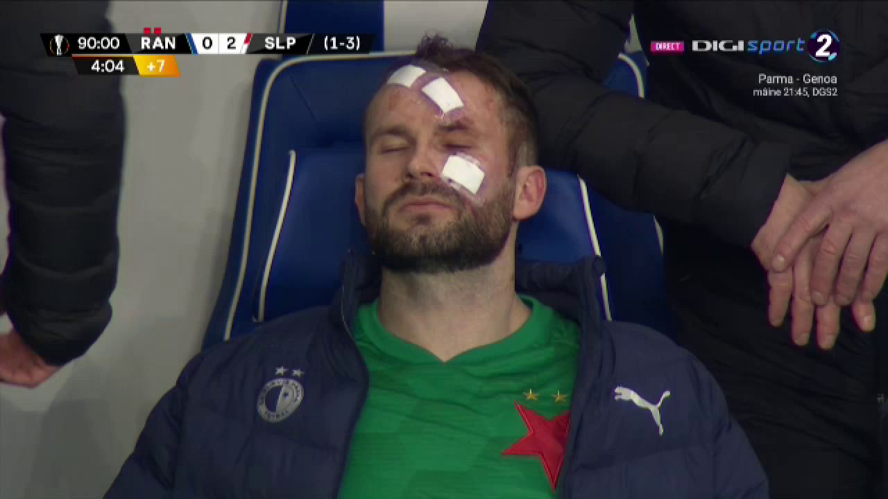 Atentie, imagini socante! Atac monstruos: i-a spart capul pur si simplu cu o lovitura dementa in Rangers - Slavia! Cum arata capul portarului dupa atac_8