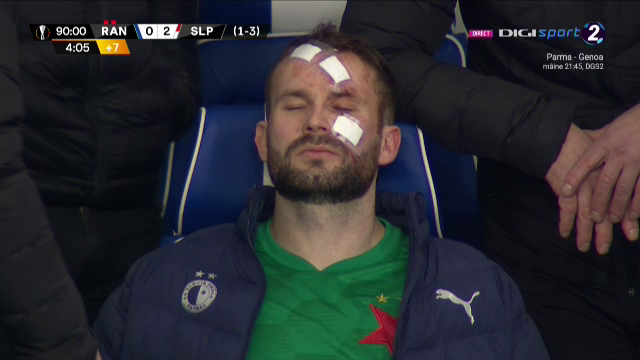 Atentie, imagini socante! Atac monstruos: i-a spart capul pur si simplu cu o lovitura dementa in Rangers - Slavia! Cum arata capul portarului dupa atac_11