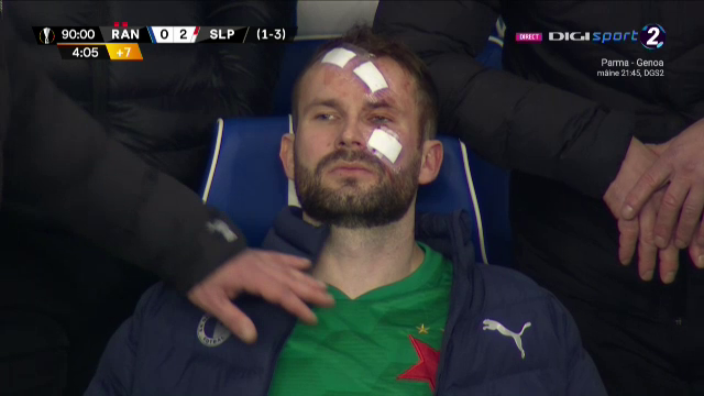 Atentie, imagini socante! Atac monstruos: i-a spart capul pur si simplu cu o lovitura dementa in Rangers - Slavia! Cum arata capul portarului dupa atac_12
