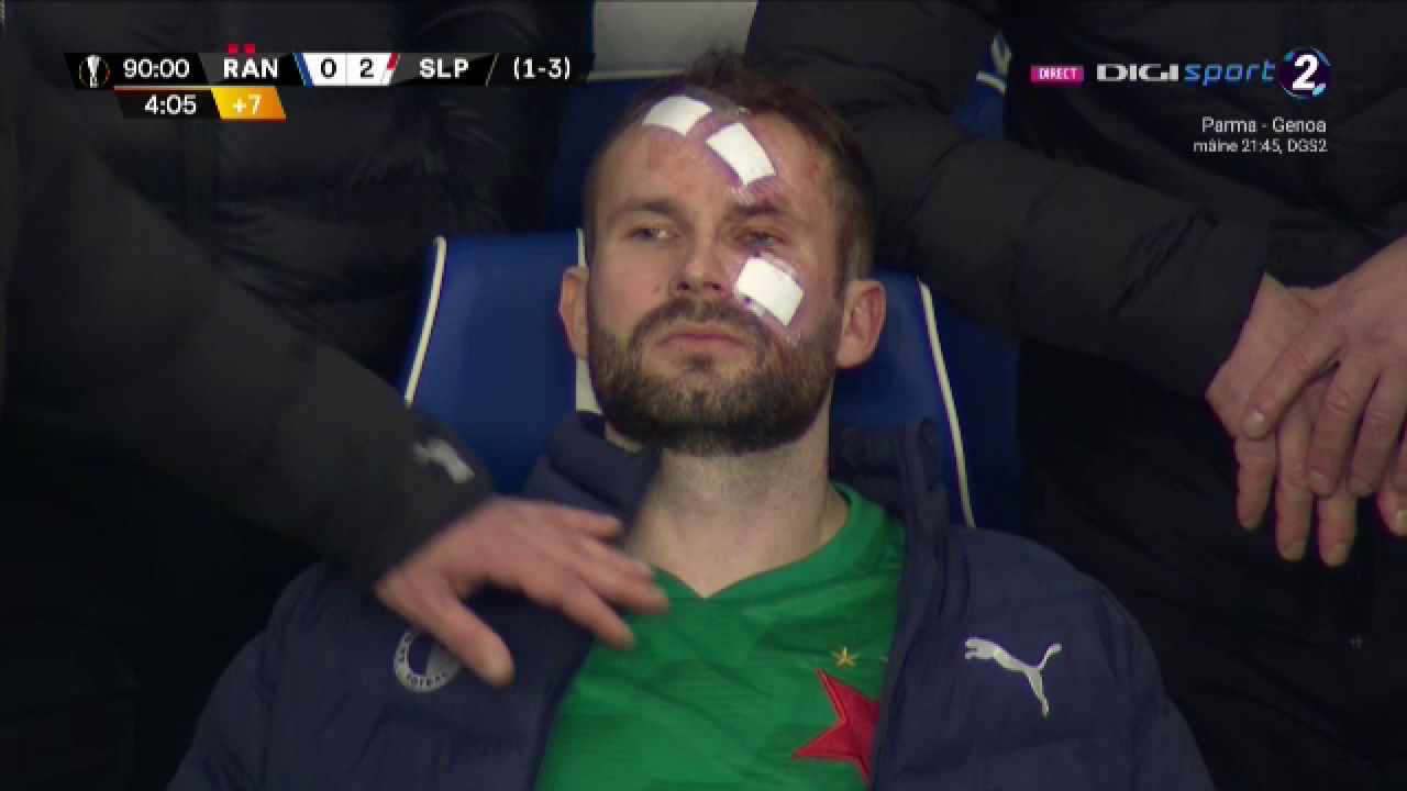 Atentie, imagini socante! Atac monstruos: i-a spart capul pur si simplu cu o lovitura dementa in Rangers - Slavia! Cum arata capul portarului dupa atac_12