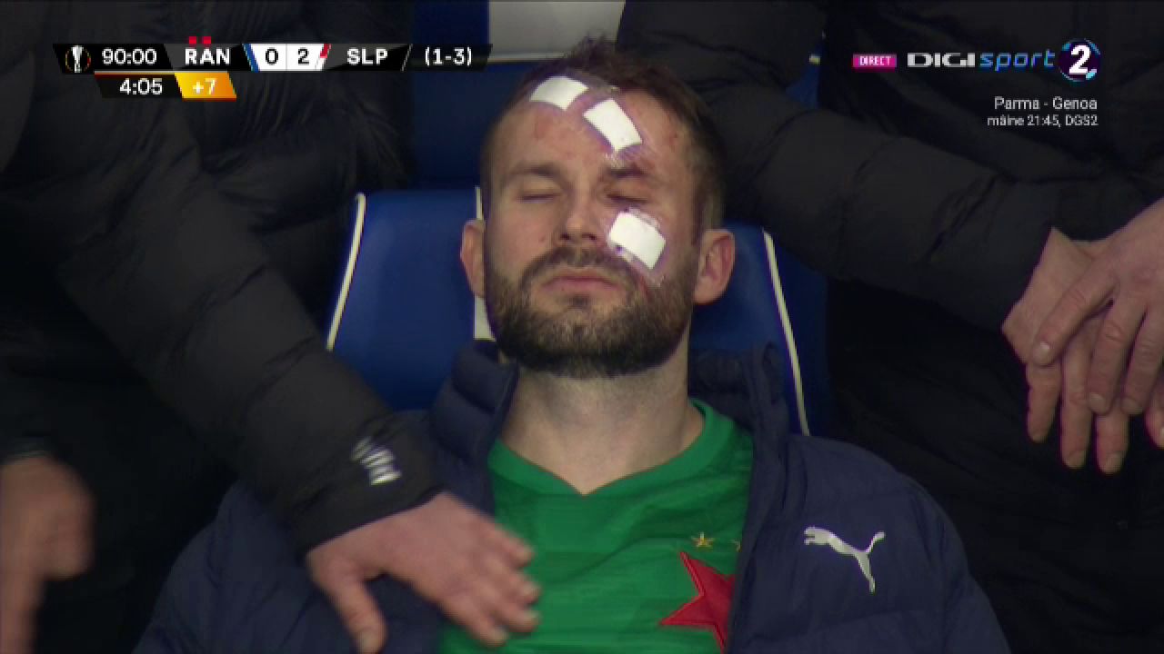 Atentie, imagini socante! Atac monstruos: i-a spart capul pur si simplu cu o lovitura dementa in Rangers - Slavia! Cum arata capul portarului dupa atac_13