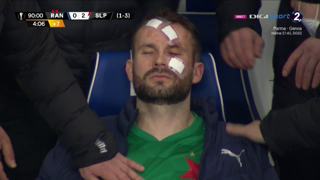 Atentie, imagini socante! Atac monstruos: i-a spart capul pur si simplu cu o lovitura dementa in Rangers - Slavia! Cum arata capul portarului dupa atac_15