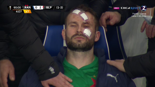 Atentie, imagini socante! Atac monstruos: i-a spart capul pur si simplu cu o lovitura dementa in Rangers - Slavia! Cum arata capul portarului dupa atac_16
