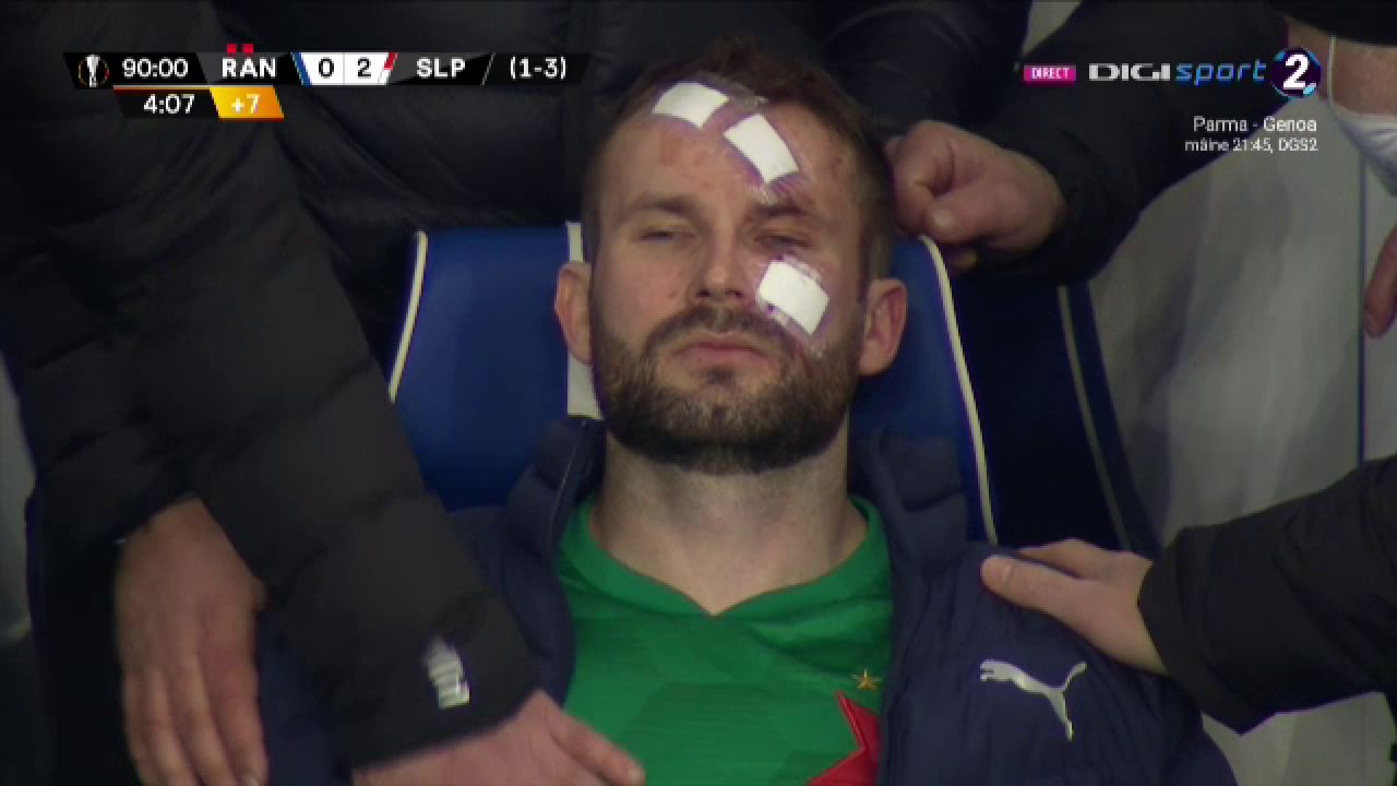 Atentie, imagini socante! Atac monstruos: i-a spart capul pur si simplu cu o lovitura dementa in Rangers - Slavia! Cum arata capul portarului dupa atac_17