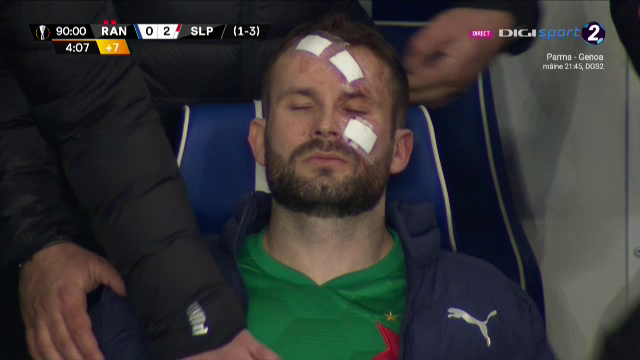 Atentie, imagini socante! Atac monstruos: i-a spart capul pur si simplu cu o lovitura dementa in Rangers - Slavia! Cum arata capul portarului dupa atac_18