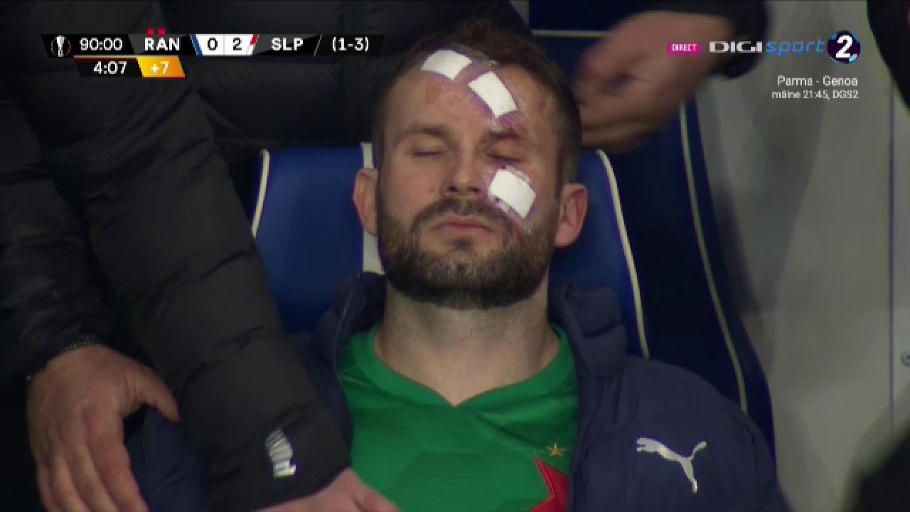 Atentie, imagini socante! Atac monstruos: i-a spart capul pur si simplu cu o lovitura dementa in Rangers - Slavia! Cum arata capul portarului dupa atac_18