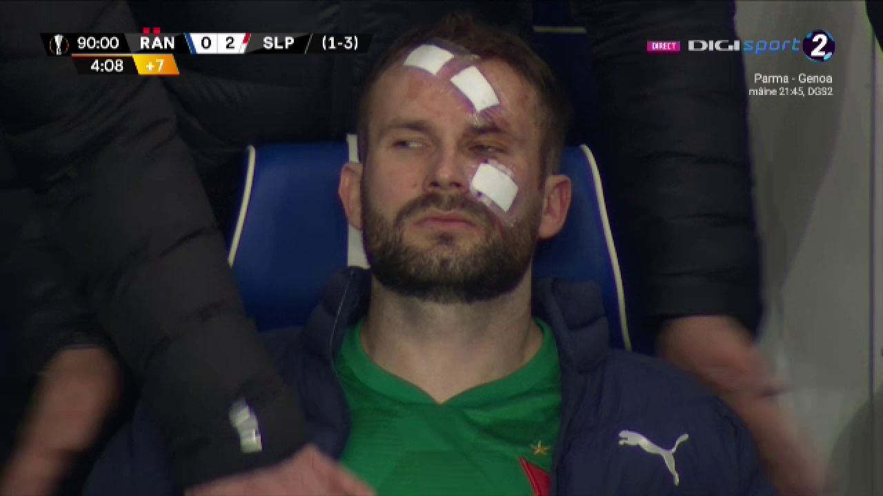 Atentie, imagini socante! Atac monstruos: i-a spart capul pur si simplu cu o lovitura dementa in Rangers - Slavia! Cum arata capul portarului dupa atac_19