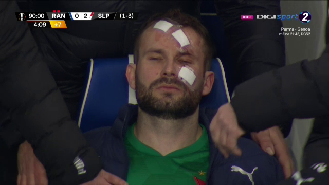 Atentie, imagini socante! Atac monstruos: i-a spart capul pur si simplu cu o lovitura dementa in Rangers - Slavia! Cum arata capul portarului dupa atac_20
