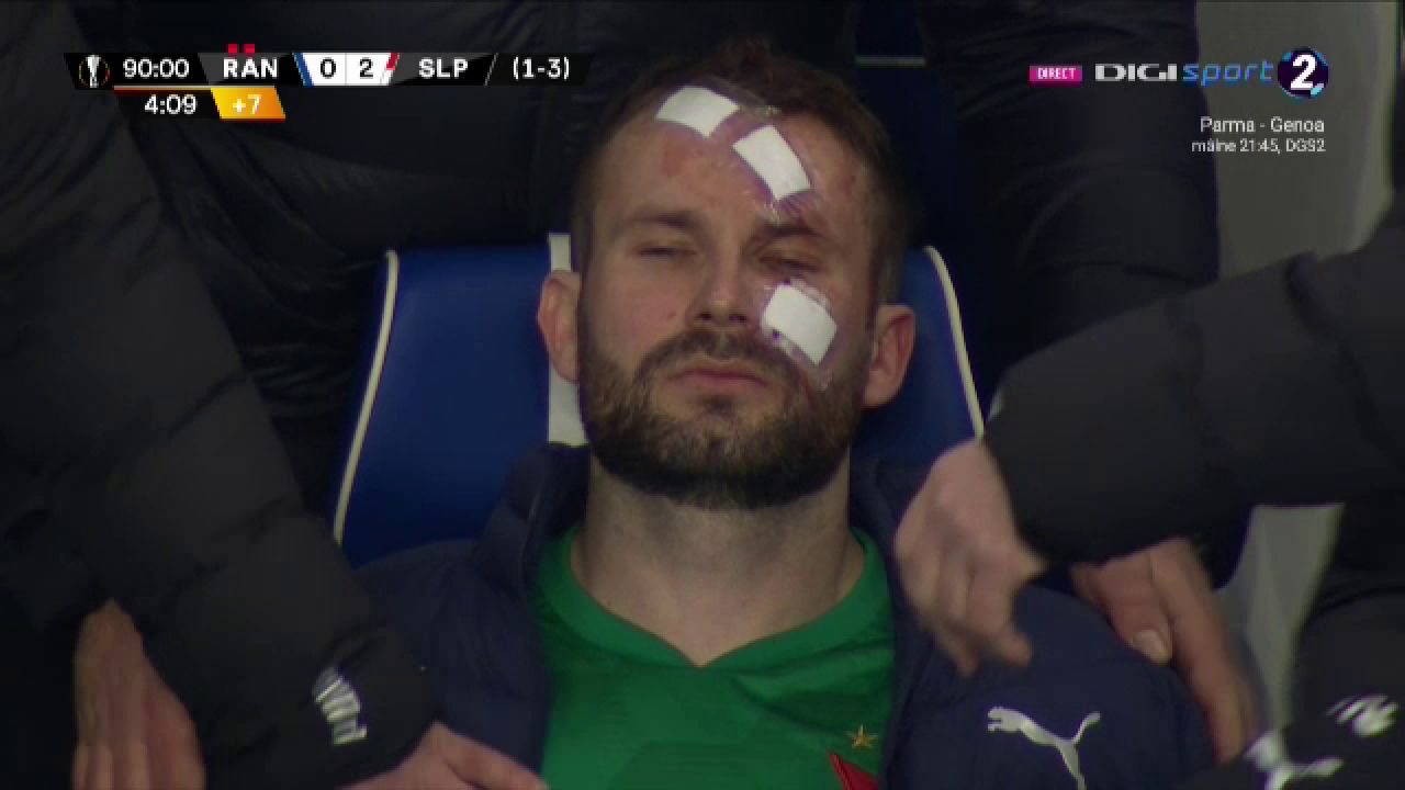 Atentie, imagini socante! Atac monstruos: i-a spart capul pur si simplu cu o lovitura dementa in Rangers - Slavia! Cum arata capul portarului dupa atac_20