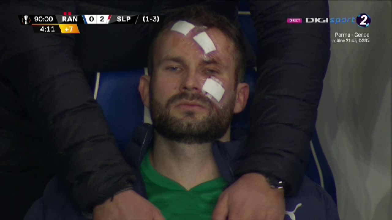Atentie, imagini socante! Atac monstruos: i-a spart capul pur si simplu cu o lovitura dementa in Rangers - Slavia! Cum arata capul portarului dupa atac_21