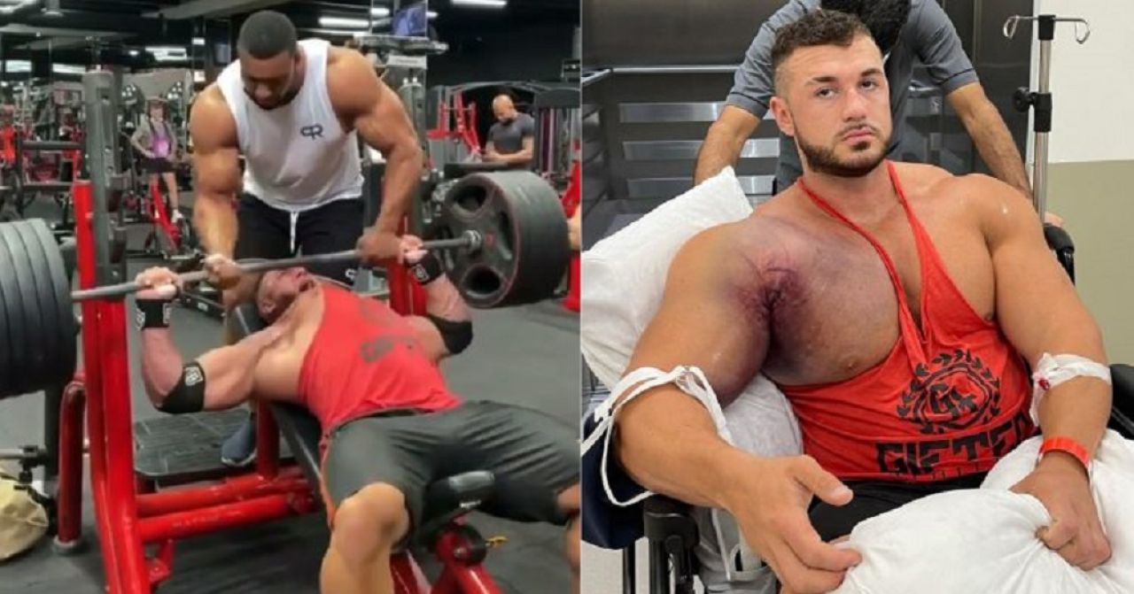 Primele imagini cu sportivul care si-a DISTRUS pieptul la antrenamente! Cum arata dupa operatia suferita si ce i-au spus medicii! Detalii cu impact emotional_1