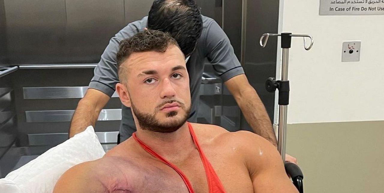 Cum arata acum corpul culturistului care si-a DISTRUS pieptul printr-o accidentare de COSMAR! Imagini si dezvaluiri cu impact emotional_1