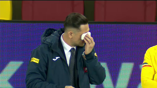 Radoi, asa cum nu l-ai mai vazut niciodata! Si-a pus picaturile in ochi inaintea meciului! Imagini EXCLUSIVE_12