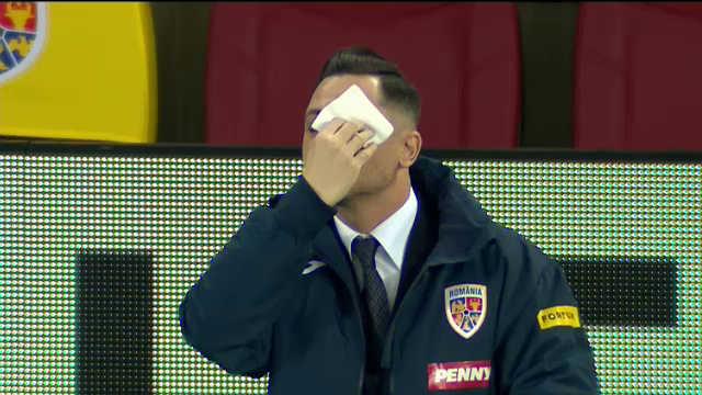 Radoi, asa cum nu l-ai mai vazut niciodata! Si-a pus picaturile in ochi inaintea meciului! Imagini EXCLUSIVE_18