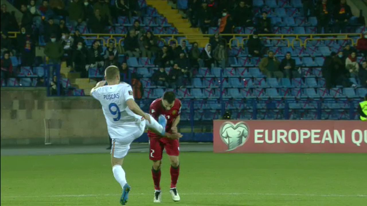 Cum arata jucatorul armean dupa intrarea de 'rosu' a lui Puscas! Imagini crunte: