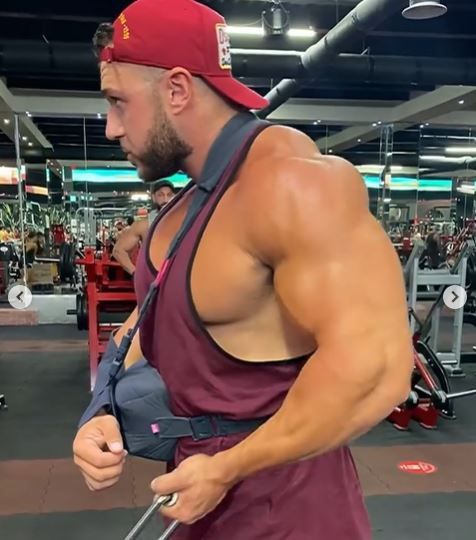 De neimaginat! Culturistul care si-a distrus pieptul la antrenamente a revenit la sala dupa mai putin de doua saptamani de la operatie! Atentie: imagini dure_9