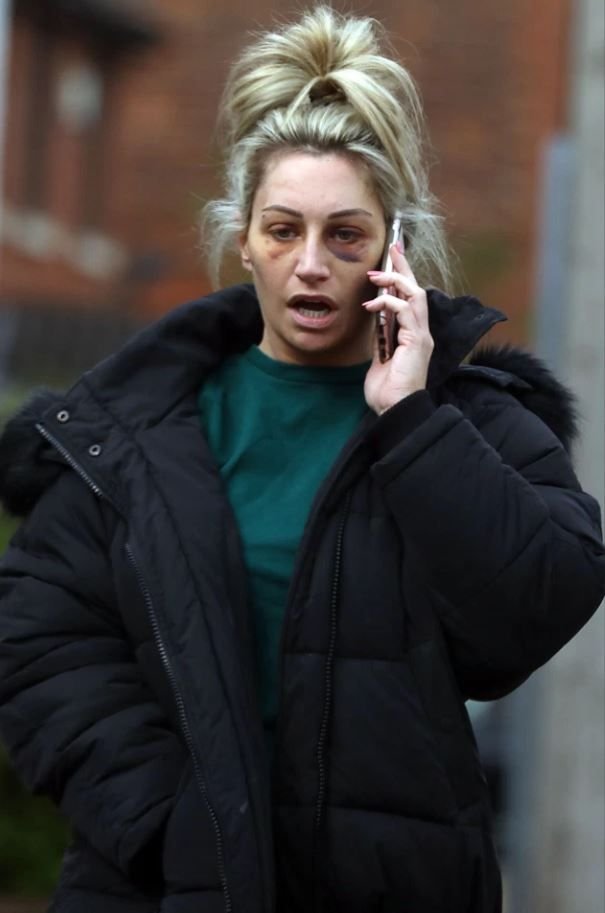Scandal imens in Anglia! Mama starului lui City, implicata intr-o bataie dupa ce s-a consumat mult alcool! O femeie a plecat muscata si cu ochii invinetiti_7