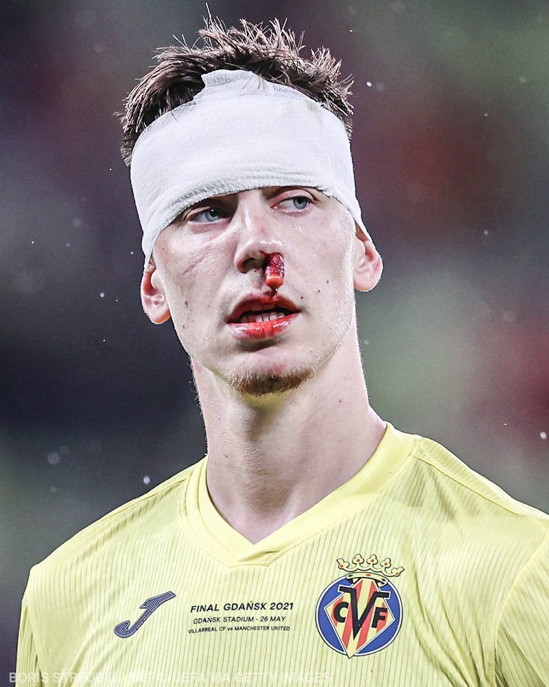 Determinare totala in finala Europa League! Foyth a ramas pe teren desi avea fata plina de sange! Pe internet circula deja glume pe seama lui_3