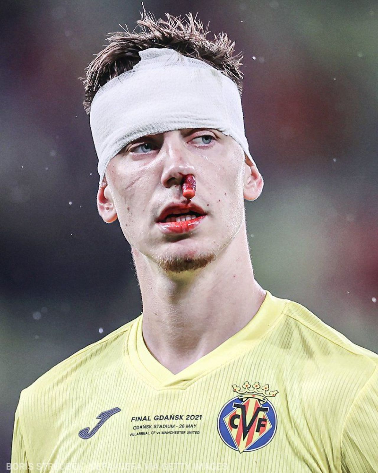 Determinare totala in finala Europa League! Foyth a ramas pe teren desi avea fata plina de sange! Pe internet circula deja glume pe seama lui_3