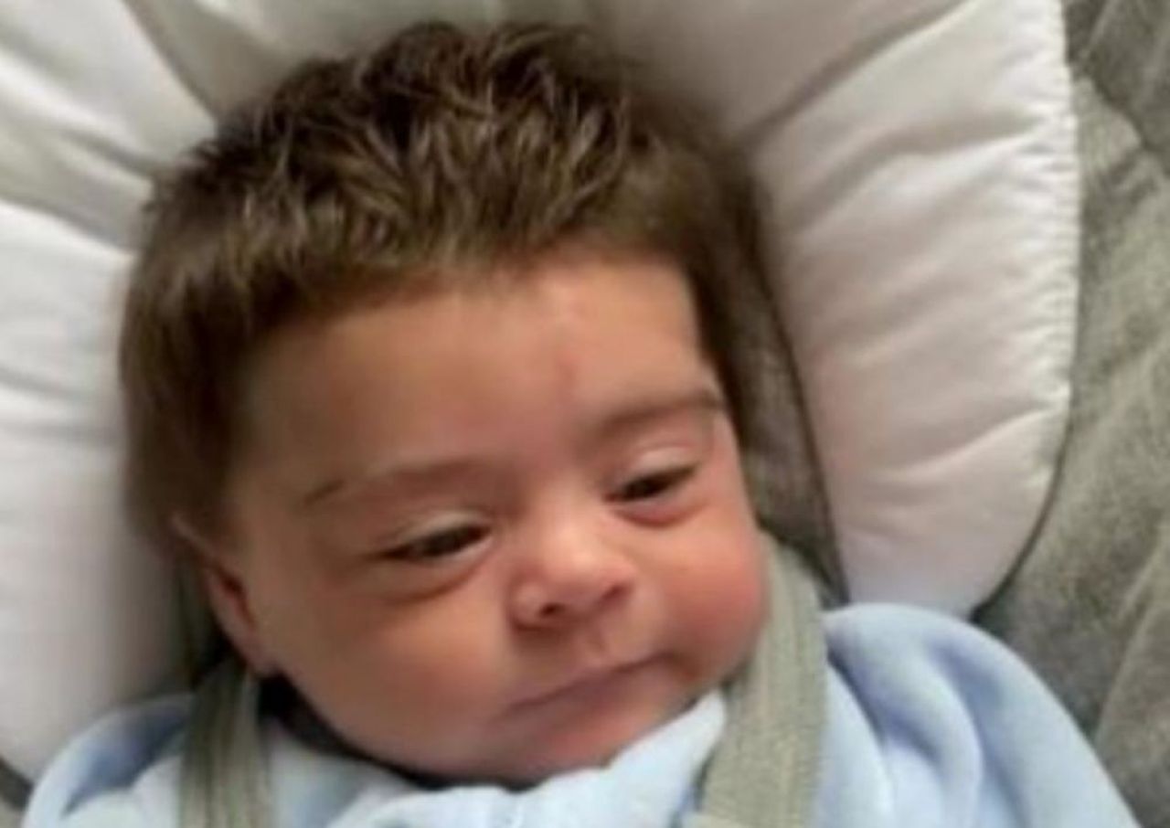 Bebelusul care a devenit viral imediat dupa nastere! Motivul incredibil pentru care pozele cu el au facut inconjurul lumii _3