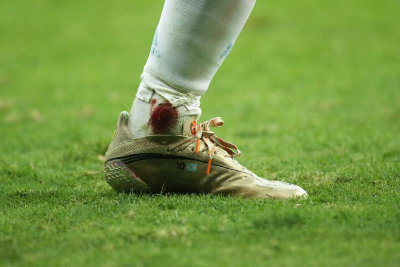 Lionel Messi, insangerat in semifinalele Copa America. A jucat accidentat din minutul 57, iar imaginile cu el au facut inconjurul lumii _7
