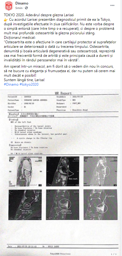 Accidentarea Larisei Iordache este mai gravă decât se credea! Diagnosticul primit de gimnastă_7