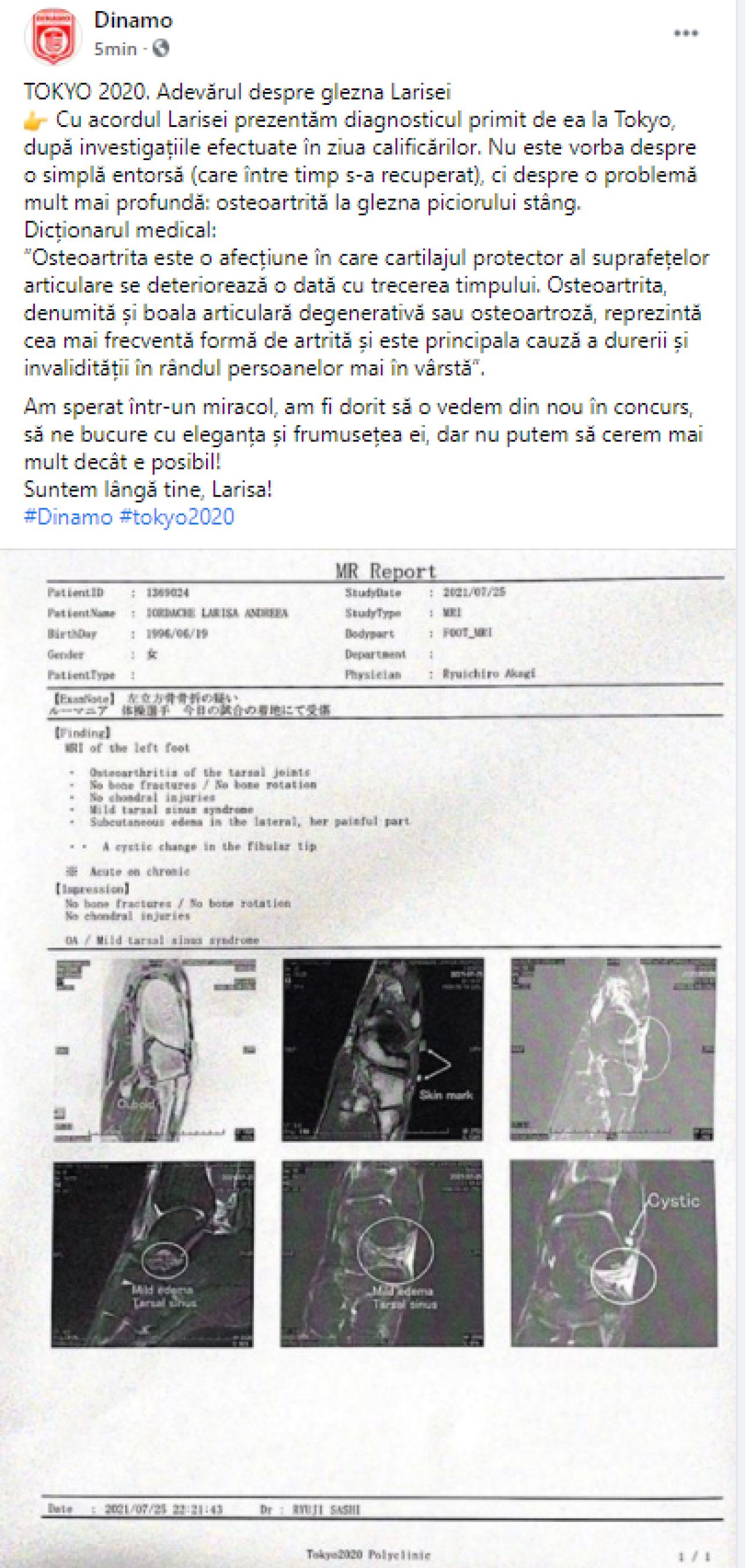 Accidentarea Larisei Iordache este mai gravă decât se credea! Diagnosticul primit de gimnastă_7