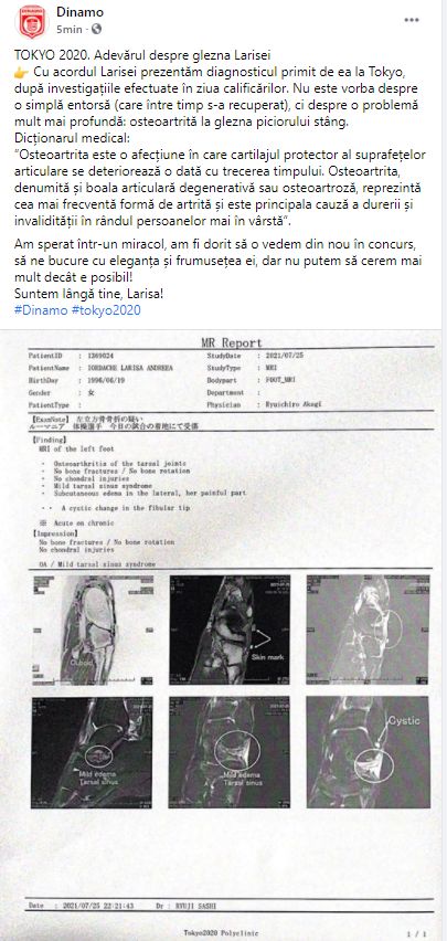 Accidentarea Larisei Iordache este mai gravă decât se credea! Diagnosticul primit de gimnastă_7