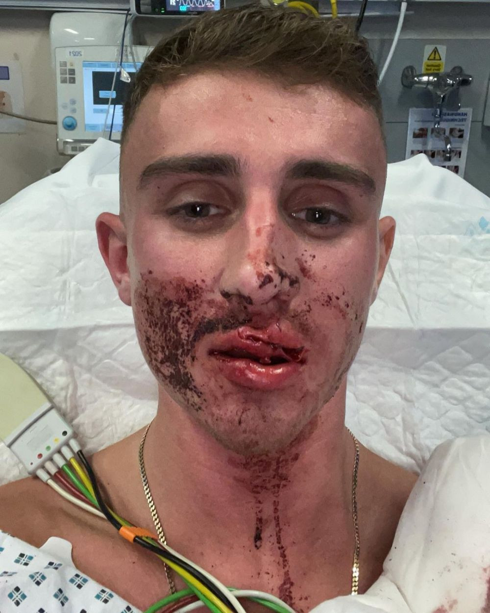 Imagini incredibile! Luptător de taekwondo care a participat la Jocurile Olimpice, bătut crunt pe stradă! Atenție,imagini cu impact emoțional&nbsp;