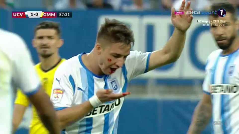 Mi se pare o prostie . Prima reacție a lui Reghecampf după ce jucătorul său a rămas fără doi dinți