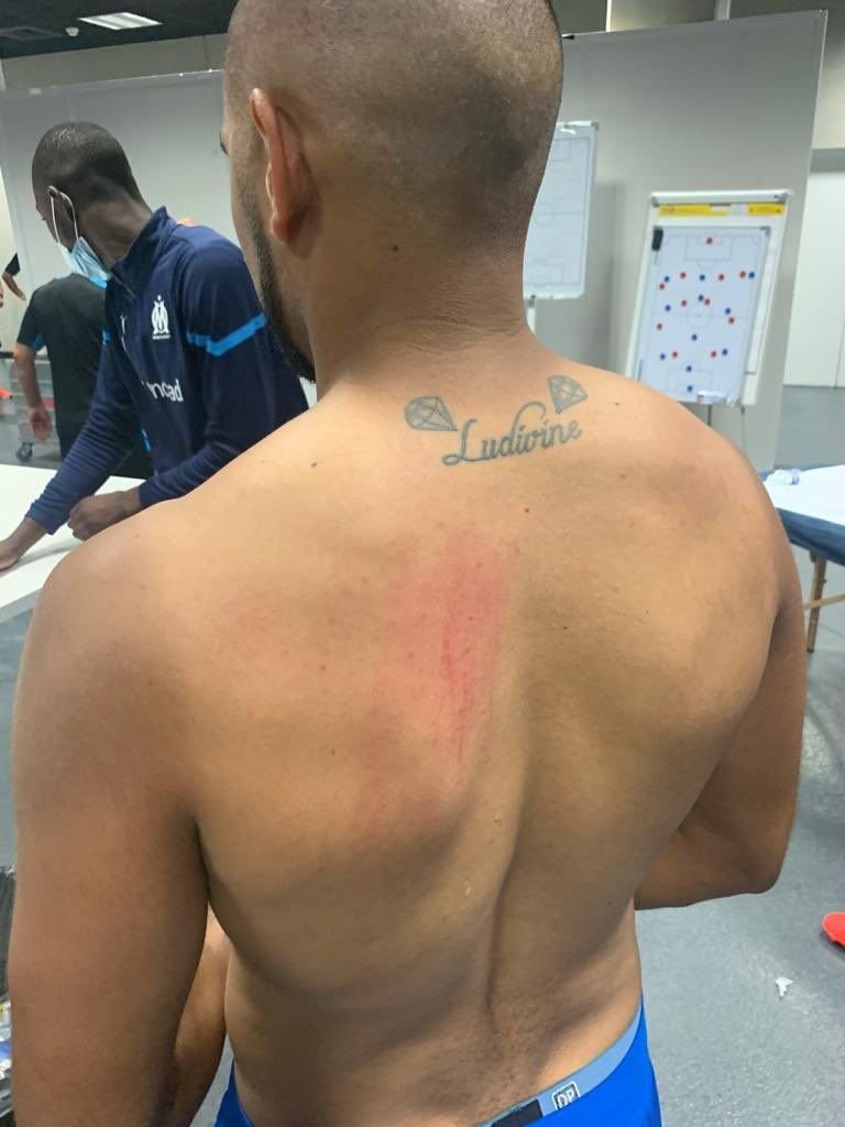 GALERIE FOTO Trei jucători de la Marseille, accidentați după incidentele de la Nice. Imagini incredibile din vestiar_17