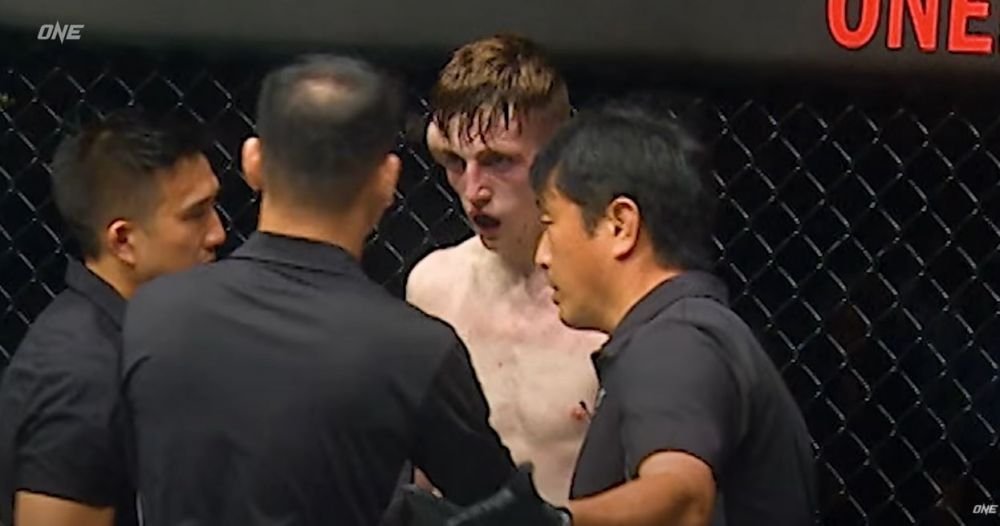Imagini extrem de dure din MMA! Un luptător s-a ales cu un hematom uriaș în timpul luptei _4