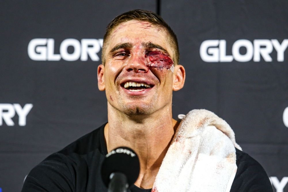 Rico Verhoeven este de neoprit! L-a învins pe Jamal cu un ochi închis după ce a încasat o lovitură dură! Imagini cu impact emoțional_8