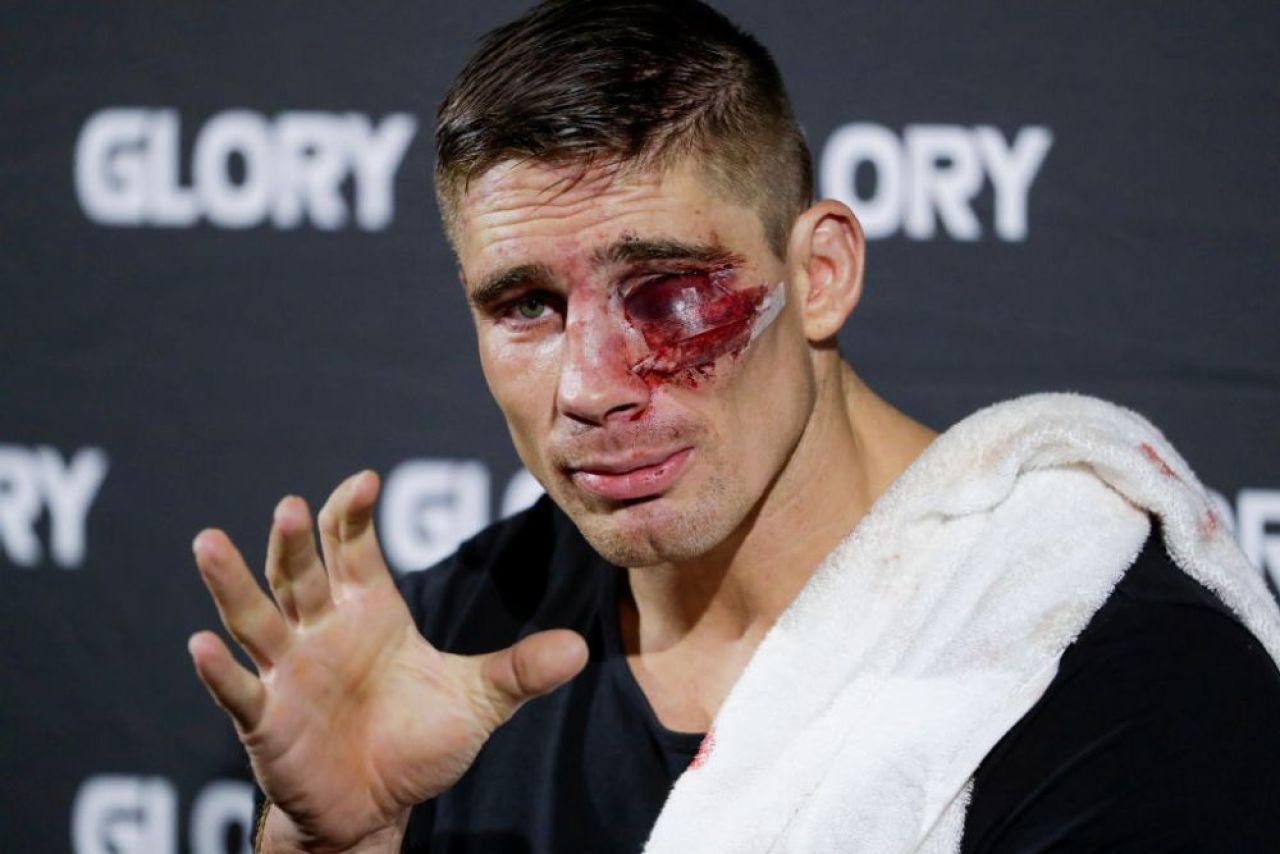 Rico Verhoeven, mai ”șifonat” ca niciodată: ”M-am uitat în oglindă. Nu cred că arătam foarte bine”_1