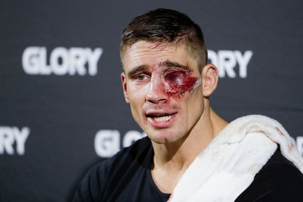 Rico Verhoeven, mai ”șifonat” ca niciodată: ”M-am uitat în oglindă. Nu cred că arătam foarte bine”_3