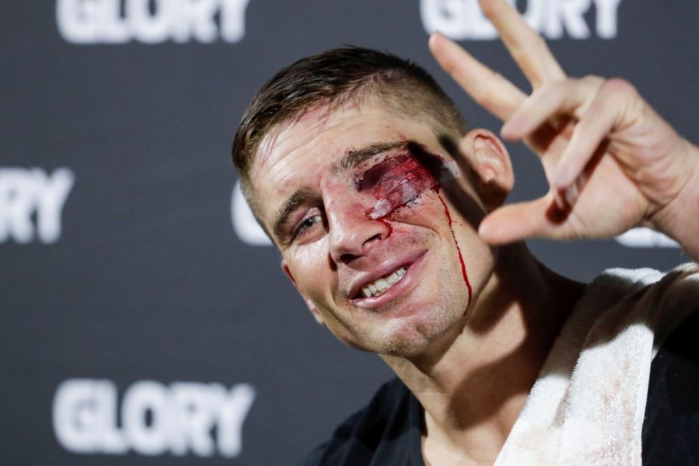 Rico Verhoeven, mai ”șifonat” ca niciodată: ”M-am uitat în oglindă. Nu cred că arătam foarte bine”_6