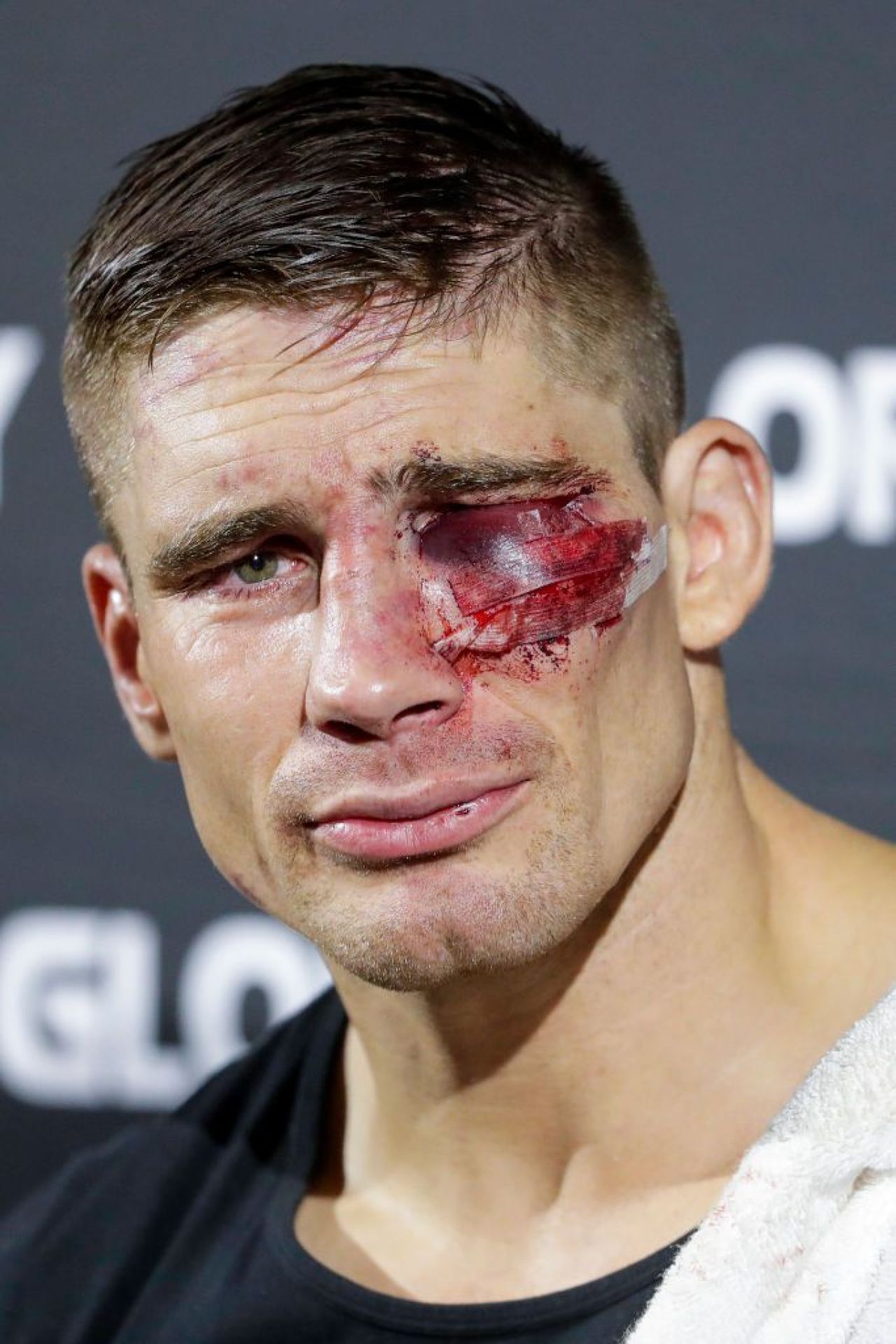 Cum arată ochiul lui Rico Verhoeven, la aproape patru săptămâni după meciul cu Jamal Ben Saddik_5