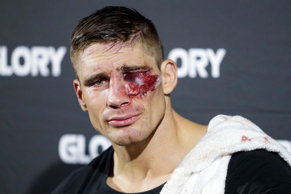 Cum arată ochiul lui Rico Verhoeven, la aproape patru săptămâni după meciul cu Jamal Ben Saddik_7