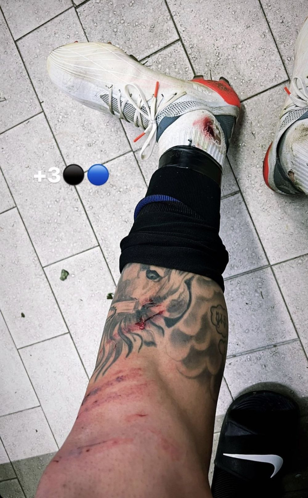 Marius Marin e lider cu Pisa &icirc;n Serie B! Cum arată piciorul său după ultima victorie