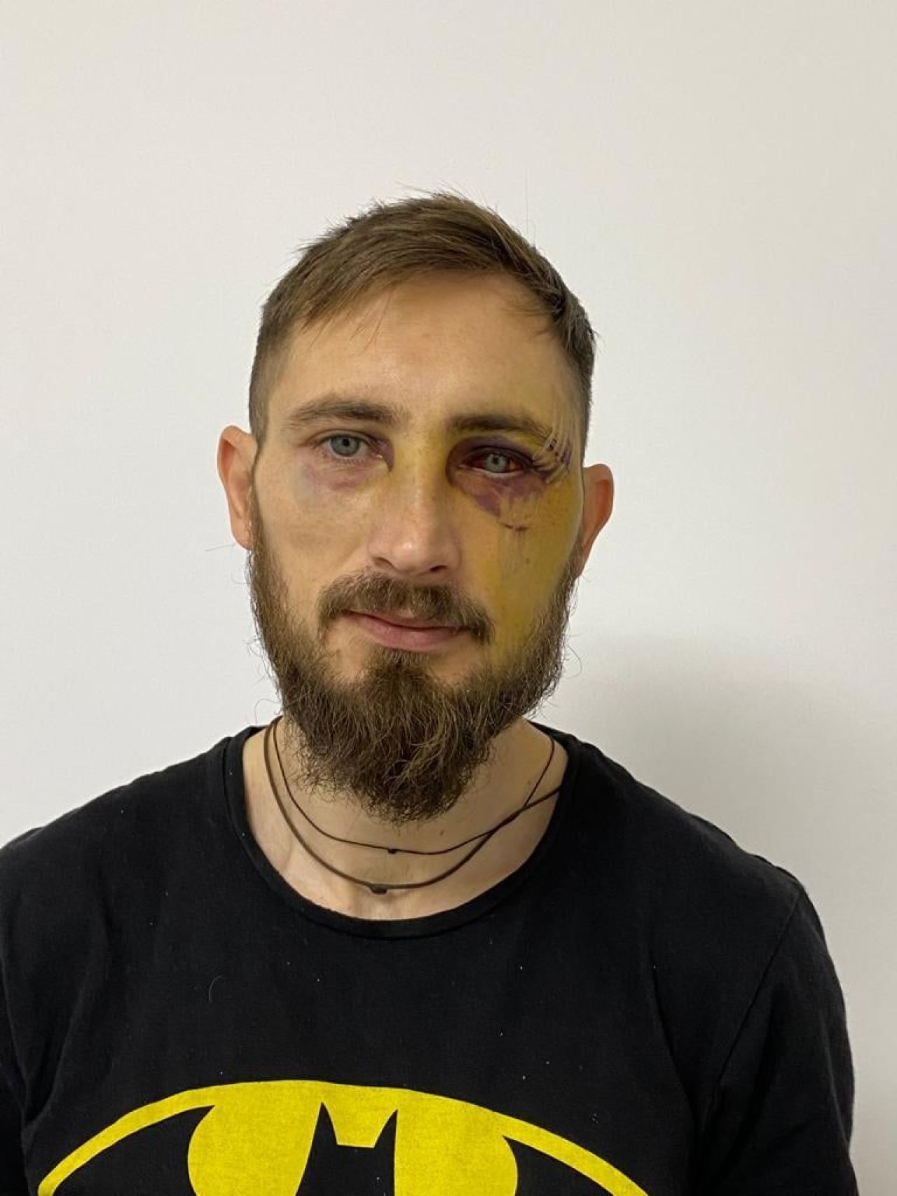 Măsura drastică luată de CS Mioveni împotriva lui Dinamo, după ce Eșanu l-a accidentat grav pe Bogdan Rusu_1