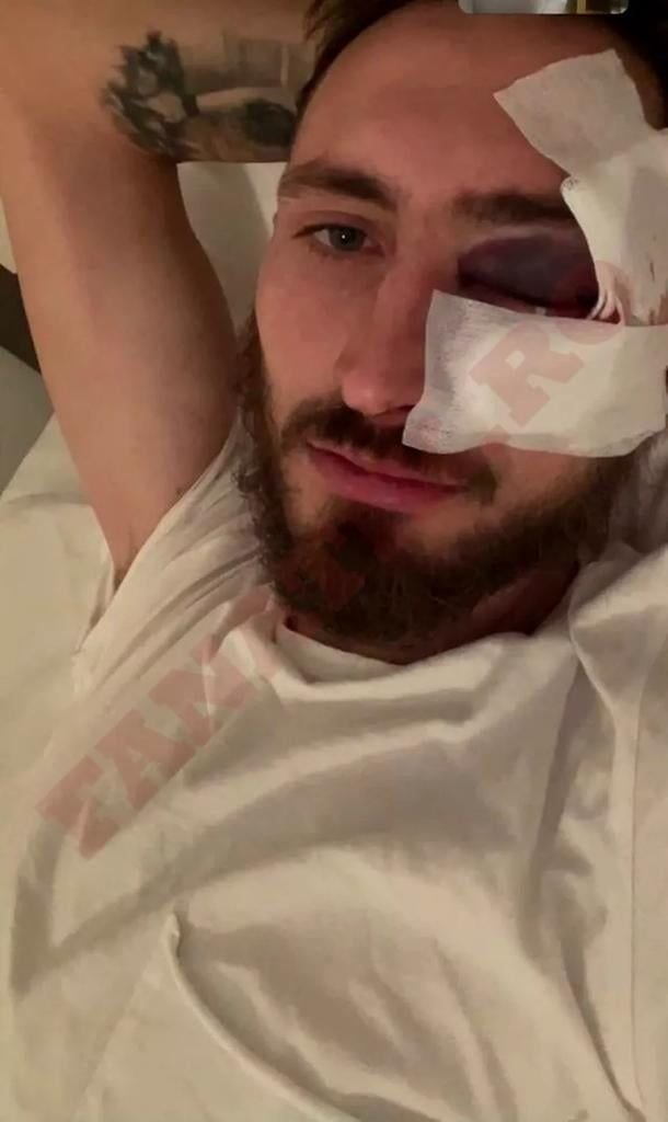 Măsura drastică luată de CS Mioveni împotriva lui Dinamo, după ce Eșanu l-a accidentat grav pe Bogdan Rusu_3