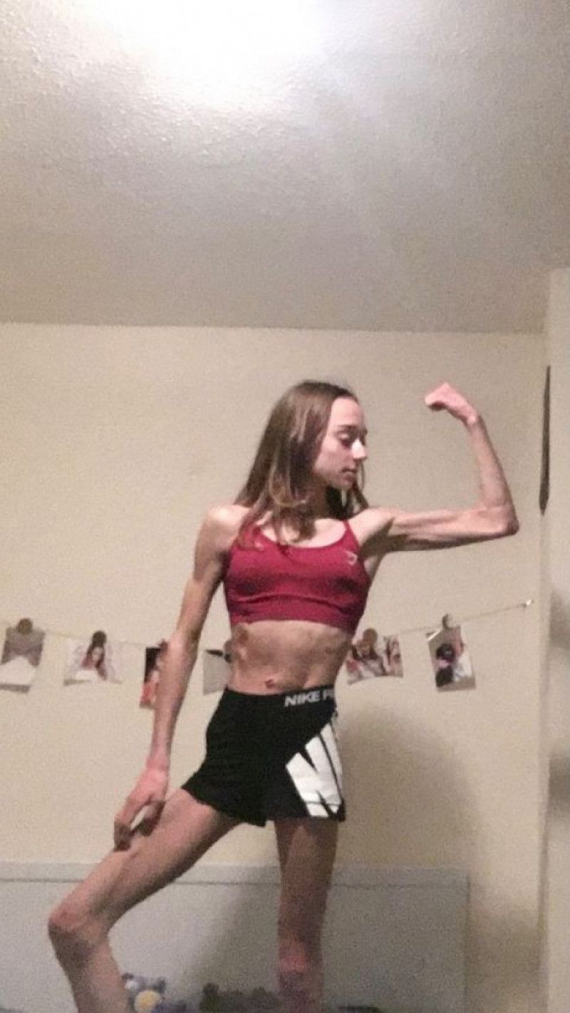 A învins anorexia, iar acum are un corp de indiviat! Cum arată tânăra pe care culturismul a salvat-o _13