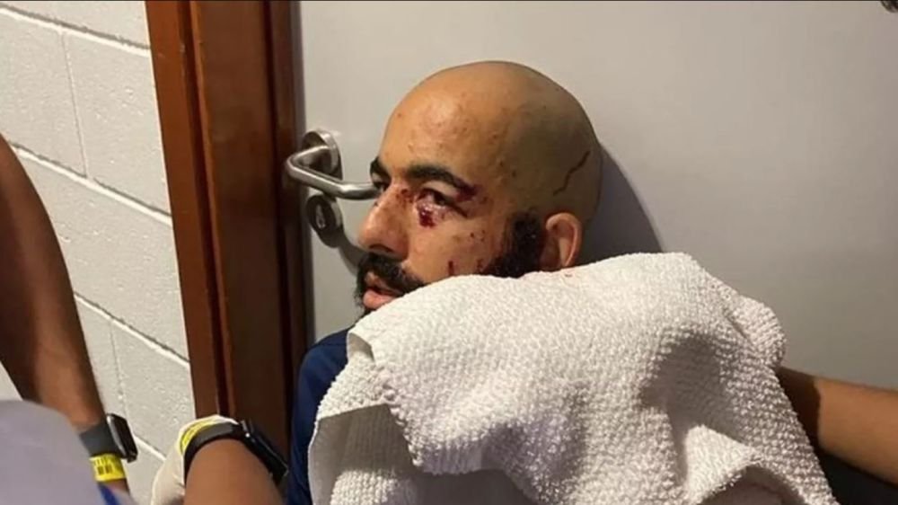 Autocarul unei echipe de fotbal, atacat cu bombă. Portarul a suferit cele mai grave răni