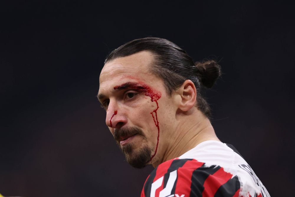 Zlatan Ibrahimovic, plin de sânge! Până să primească îngrijiri medicale, a avut ceva de împărțit de arbitrul_18